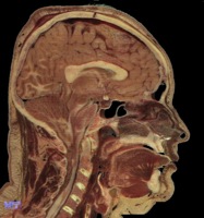 Pituitary.jpg